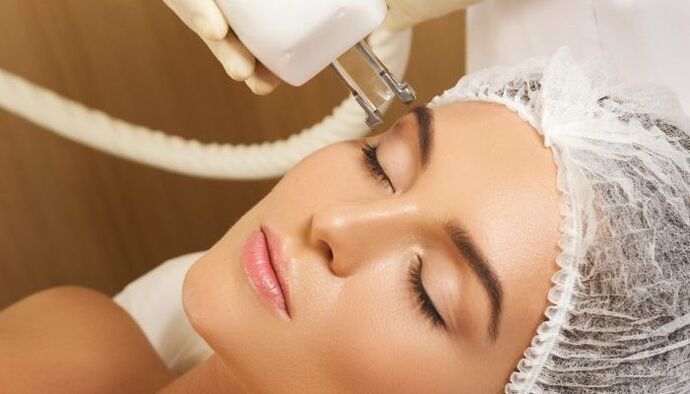 თერმოლიფტინგი