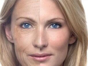 კანის პიგმენტაცია