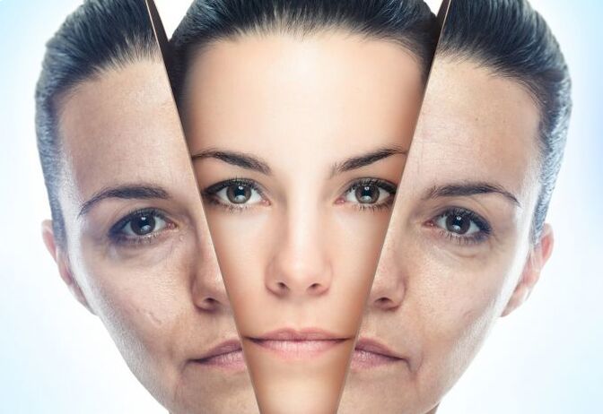 სახის კანის მოცილების პროცესი ასაკთან დაკავშირებული ცვლილებებისგან